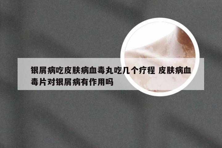 银屑病吃皮肤病血毒丸吃几个疗程 皮肤病血毒片对银屑病有作用吗