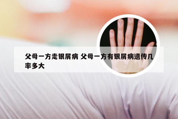 父母一方走银屑病 父母一方有银屑病遗传几率多大