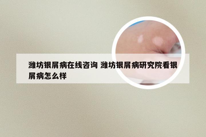 潍坊银屑病在线咨询 潍坊银屑病研究院看银屑病怎么样