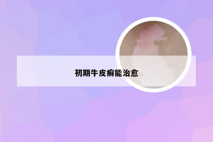 初期牛皮癣能治愈