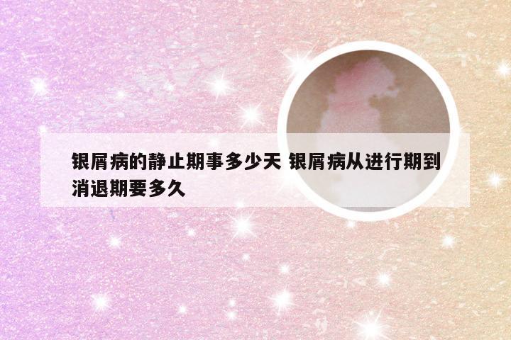 银屑病的静止期事多少天 银屑病从进行期到消退期要多久