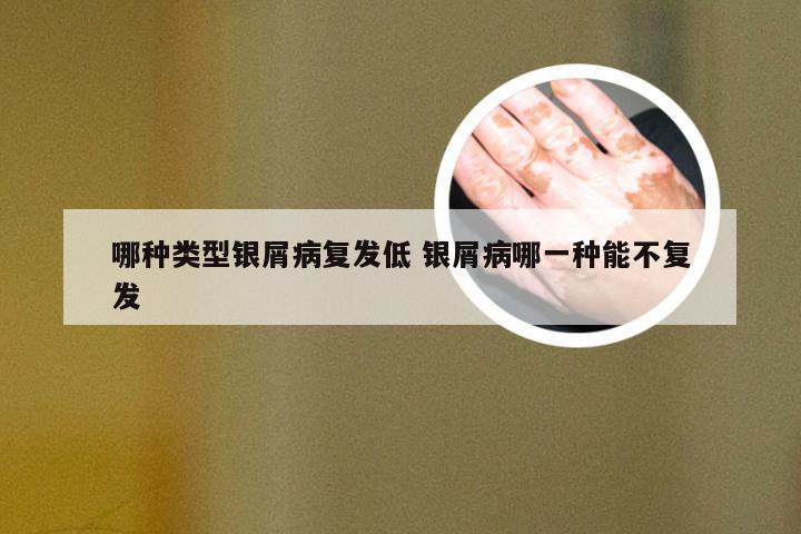 哪种类型银屑病复发低 银屑病哪一种能不复发