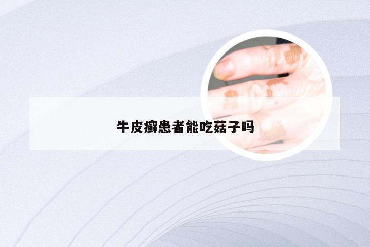 牛皮癣患者能吃菇子吗