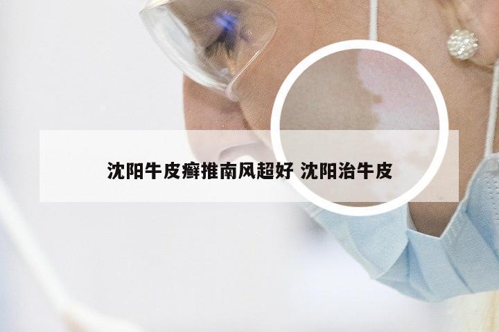 沈阳牛皮癣推南风超好 沈阳治牛皮