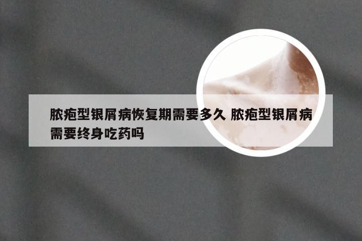 脓疱型银屑病恢复期需要多久 脓疱型银屑病需要终身吃药吗
