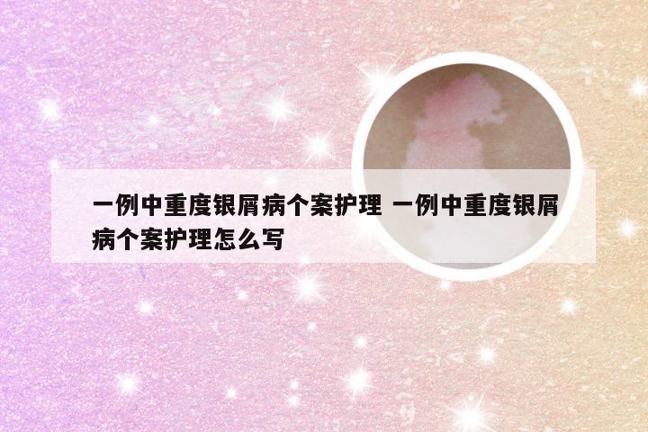 一例中重度银屑病个案护理 一例中重度银屑病个案护理怎么写