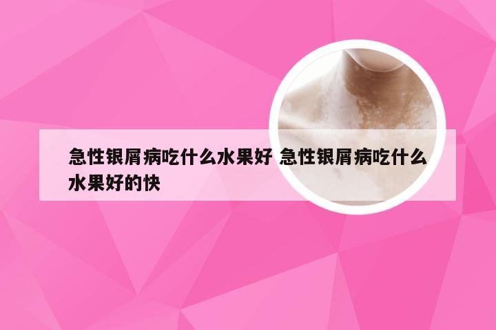 急性银屑病吃什么水果好 急性银屑病吃什么水果好的快