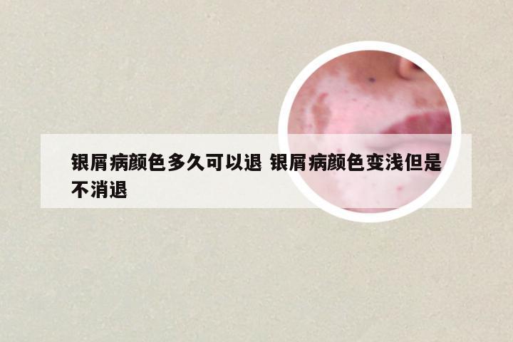 银屑病颜色多久可以退 银屑病颜色变浅但是不消退