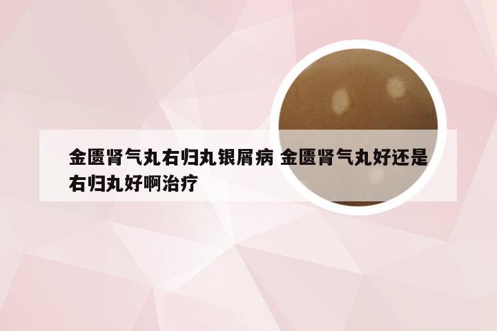 金匮肾气丸右归丸银屑病 金匮肾气丸好还是右归丸好啊治疗