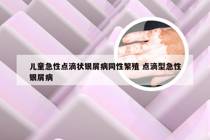儿童急性点滴状银屑病同性繁殖 点滴型急性银屑病