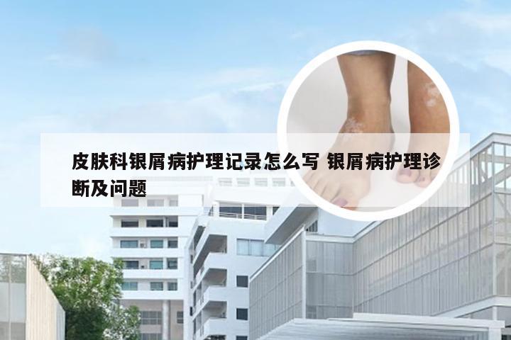 皮肤科银屑病护理记录怎么写 银屑病护理诊断及问题