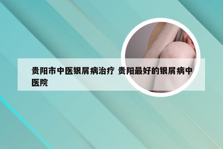 贵阳市中医银屑病治疗 贵阳最好的银屑病中医院