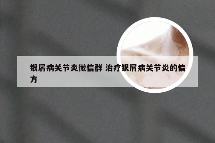 银屑病关节炎微信群 治疗银屑病关节炎的偏方