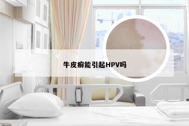 牛皮癣能引起HPV吗