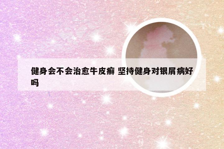 健身会不会治愈牛皮癣 坚持健身对银屑病好吗