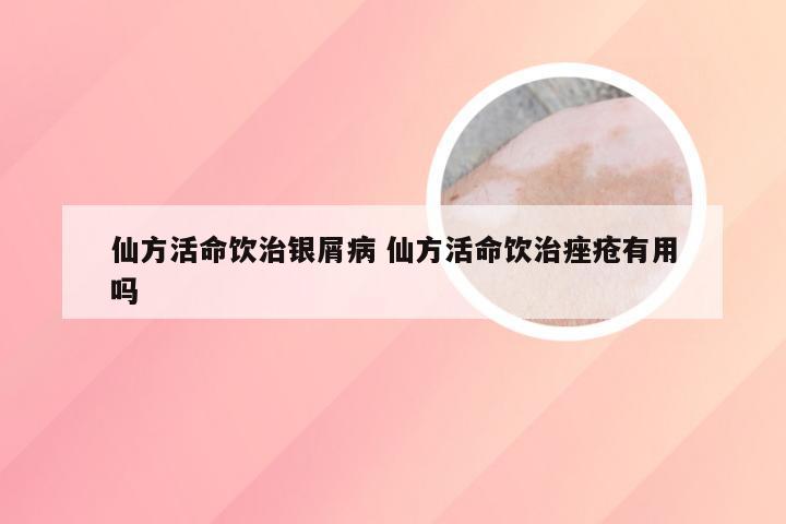 仙方活命饮治银屑病 仙方活命饮治痤疮有用吗