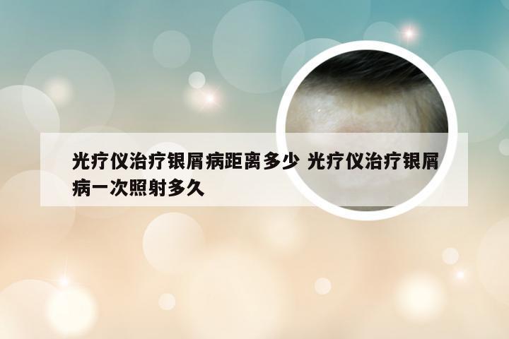 光疗仪治疗银屑病距离多少 光疗仪治疗银屑病一次照射多久