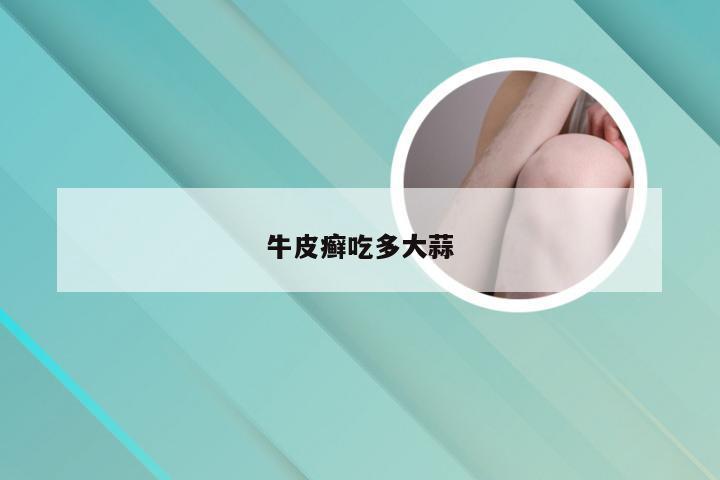 牛皮癣吃多大蒜