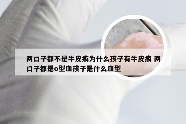 两口子都不是牛皮癣为什么孩子有牛皮癣 两口子都是o型血孩子是什么血型