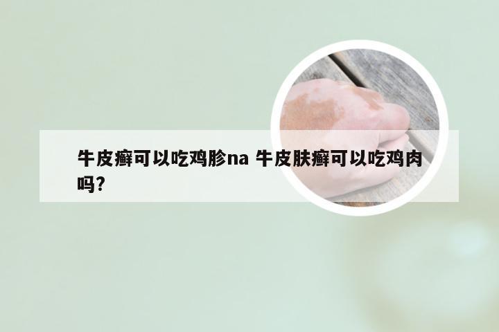 牛皮癣可以吃鸡胗na 牛皮肤癣可以吃鸡肉吗?