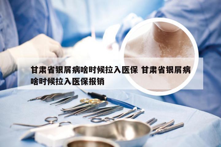 甘肃省银屑病啥时候拉入医保 甘肃省银屑病啥时候拉入医保报销