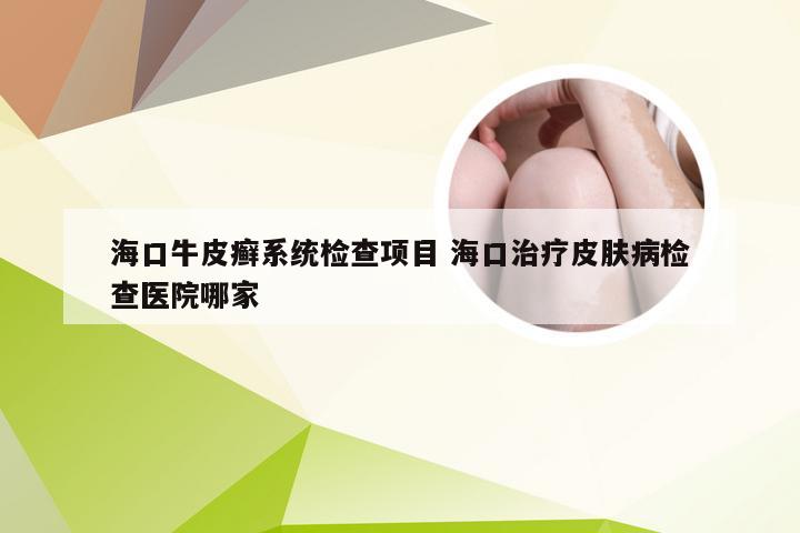 海口牛皮癣系统检查项目 海口治疗皮肤病检查医院哪家
