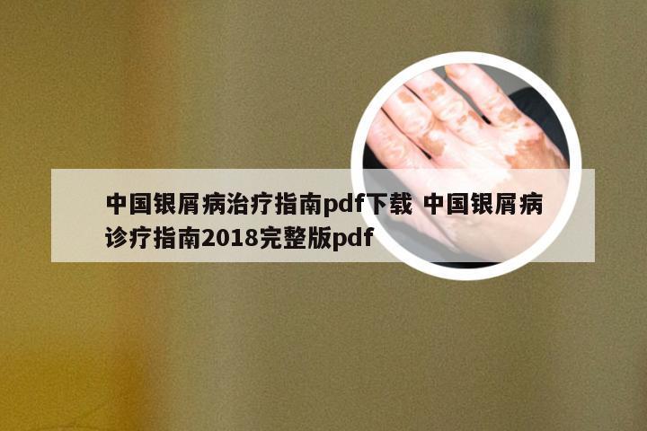 中国银屑病治疗指南pdf下载 中国银屑病诊疗指南2018完整版pdf