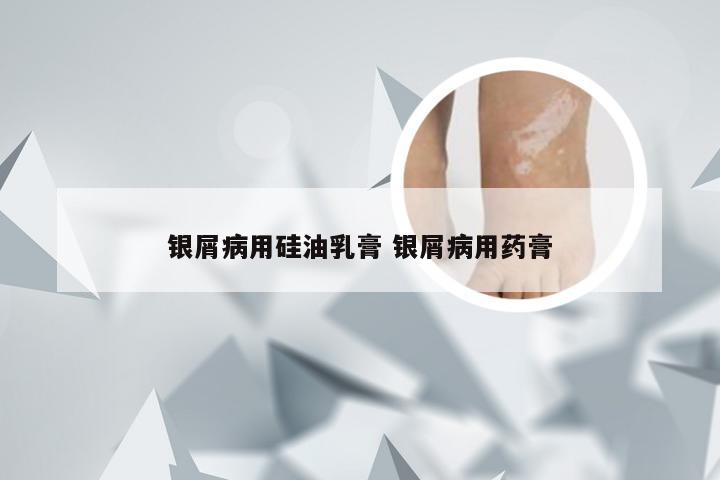银屑病用硅油乳膏 银屑病用药膏