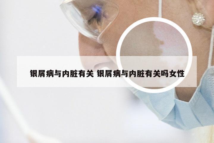 银屑病与内脏有关 银屑病与内脏有关吗女性