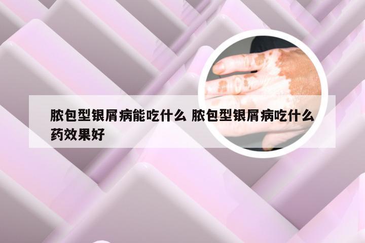 脓包型银屑病能吃什么 脓包型银屑病吃什么药效果好