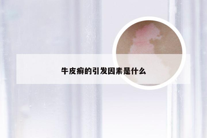 牛皮癣的引发因素是什么