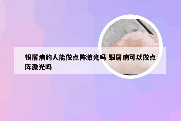 银屑病的人能做点阵激光吗 银屑病可以做点阵激光吗