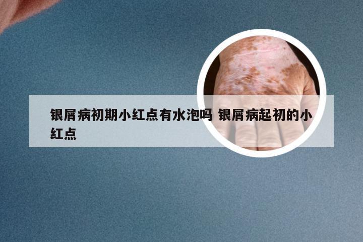 银屑病初期小红点有水泡吗 银屑病起初的小红点