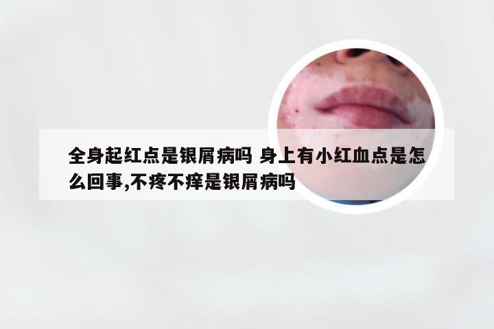 全身起红点是银屑病吗 身上有小红血点是怎么回事,不疼不痒是银屑病吗