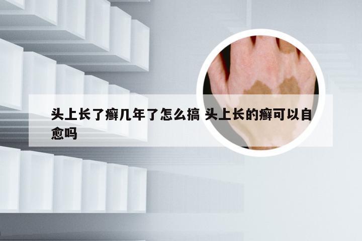 头上长了癣几年了怎么搞 头上长的癣可以自愈吗