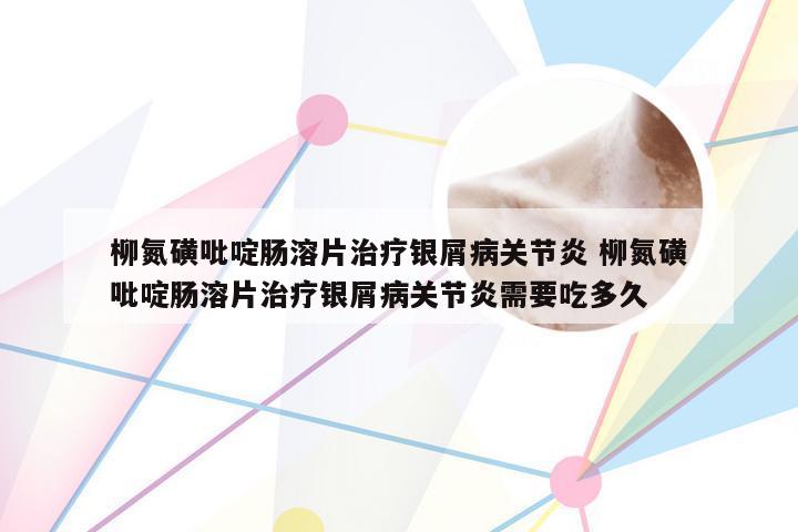 柳氮磺吡啶肠溶片治疗银屑病关节炎 柳氮磺吡啶肠溶片治疗银屑病关节炎需要吃多久