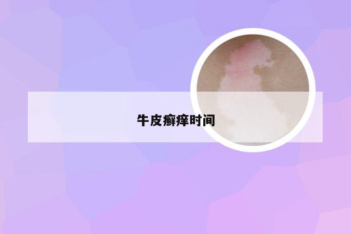 牛皮癣痒时间