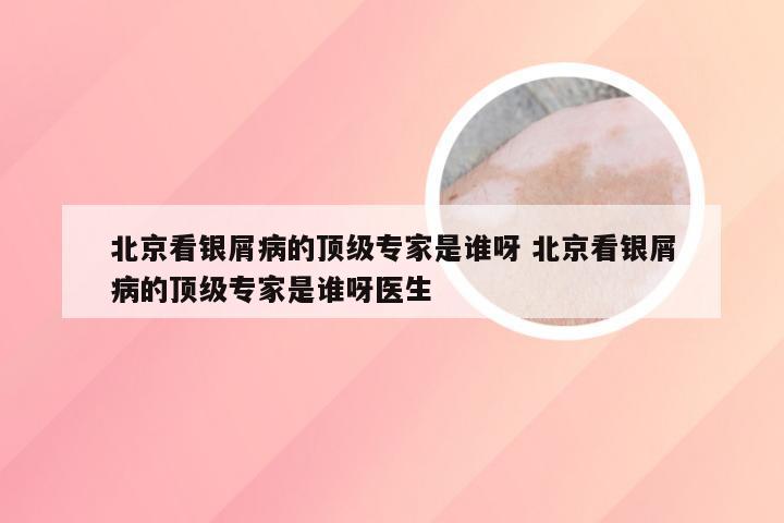 北京看银屑病的顶级专家是谁呀 北京看银屑病的顶级专家是谁呀医生