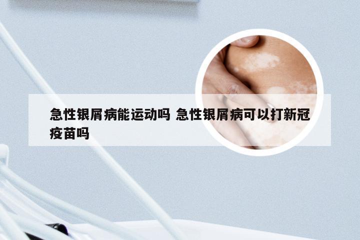急性银屑病能运动吗 急性银屑病可以打新冠疫苗吗