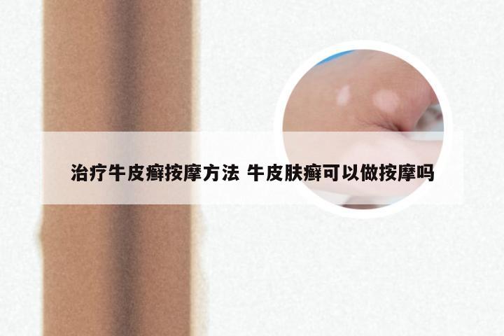 治疗牛皮癣按摩方法 牛皮肤癣可以做按摩吗