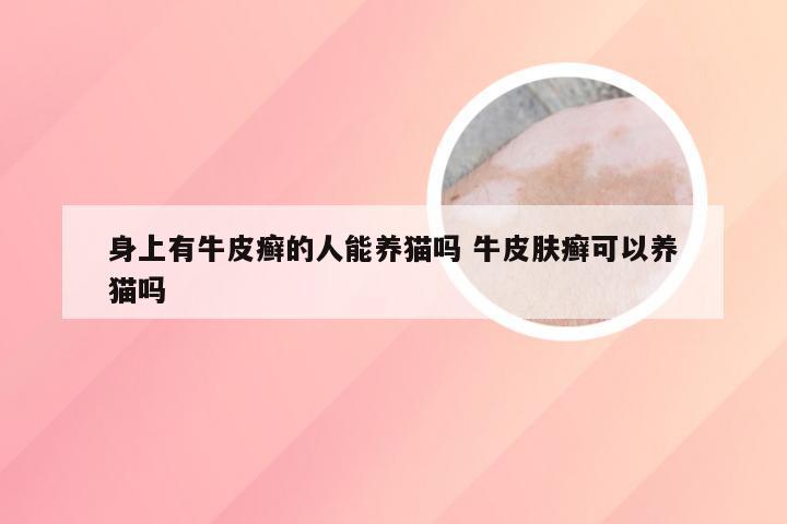 身上有牛皮癣的人能养猫吗 牛皮肤癣可以养猫吗