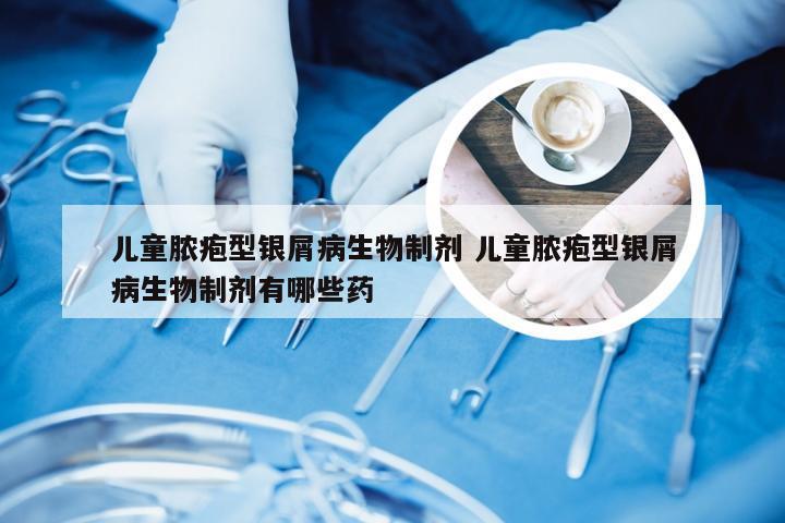 儿童脓疱型银屑病生物制剂 儿童脓疱型银屑病生物制剂有哪些药
