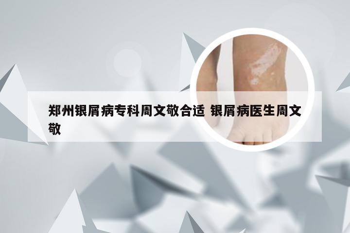 郑州银屑病专科周文敬合适 银屑病医生周文敬