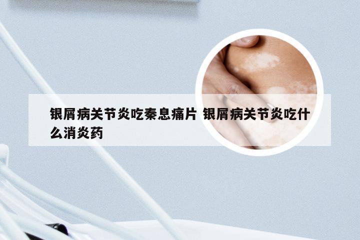 银屑病关节炎吃秦息痛片 银屑病关节炎吃什么消炎药