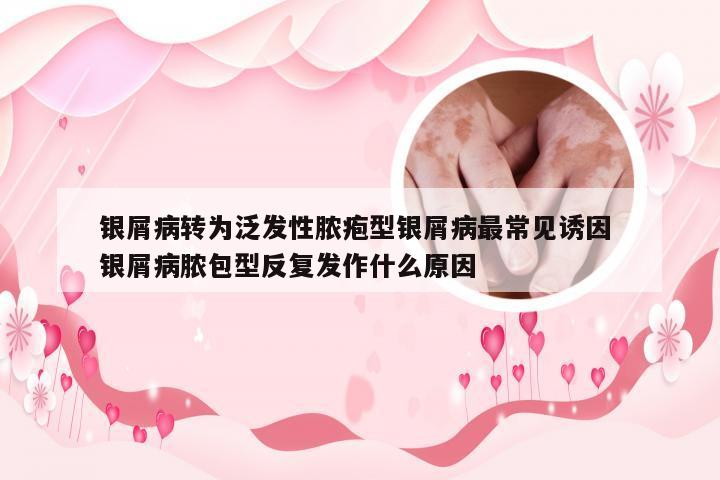 银屑病转为泛发性脓疱型银屑病最常见诱因 银屑病脓包型反复发作什么原因