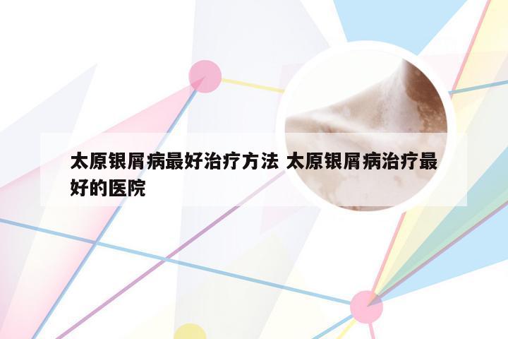 太原银屑病最好治疗方法 太原银屑病治疗最好的医院