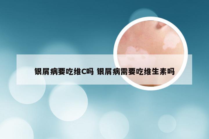银屑病要吃维C吗 银屑病需要吃维生素吗