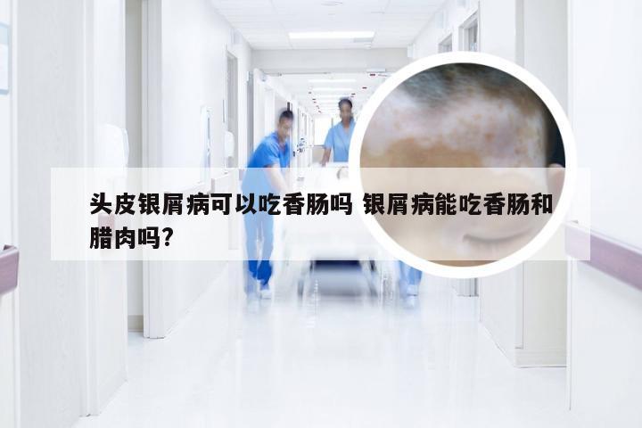 头皮银屑病可以吃香肠吗 银屑病能吃香肠和腊肉吗?
