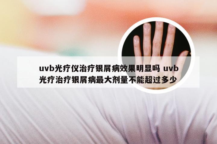 uvb光疗仪治疗银屑病效果明显吗 uvb光疗治疗银屑病最大剂量不能超过多少