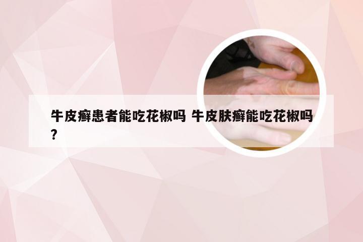 牛皮癣患者能吃花椒吗 牛皮肤癣能吃花椒吗?